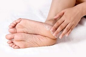 trattamento della crema per funghi della pelle del piede